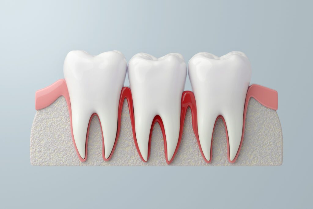 periodontal therapy for diabetic patients in dallas